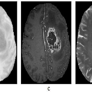 Sample Images Of BRATS Dataset A FLAIR B T1 C T1C D T2 And E