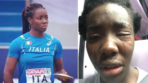 Una Atleta Nigeriana Fue Víctima Del Racismo En Italia Sentí Un Fuerte Golpe En El Ojo Temía