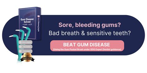 The Stages Of Gum Disease Explained By Our Expert Dentists