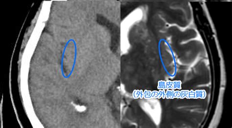 ctmri radiographica