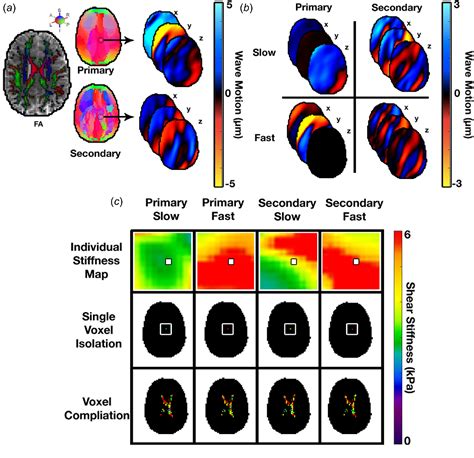 Figure 2 From Multi Excitation Mr Elastography Of The Brain Wave