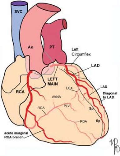 Coronary Arteries Thoracic Key