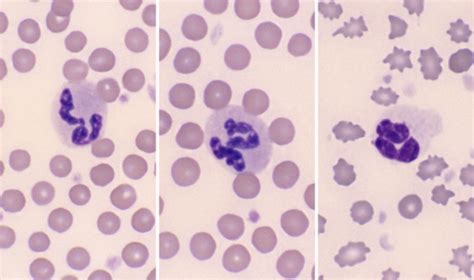 WBC Morphology Practice VetClinPath Flashcards Quizlet