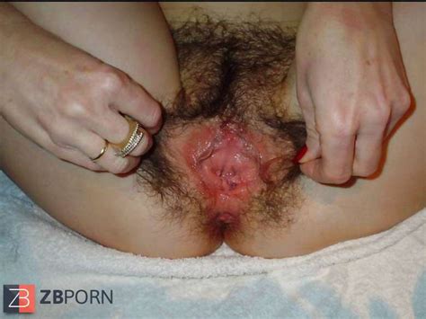 Fur Covered Vulva ZB Porn