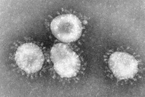 Virus Under Electron Microscope