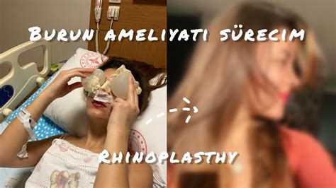 BURUN AMELİYATI SÜRECİM RHİNOPLASTY YouTube