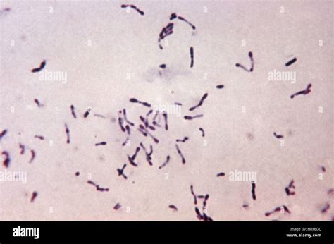 Corynebacterium Species Gram Stain