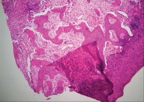 A Review Of Artifacts In Histopathology Abstract Europe Pmc