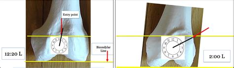 Three Dimensional Reproductions For Surgical Decision Making In The