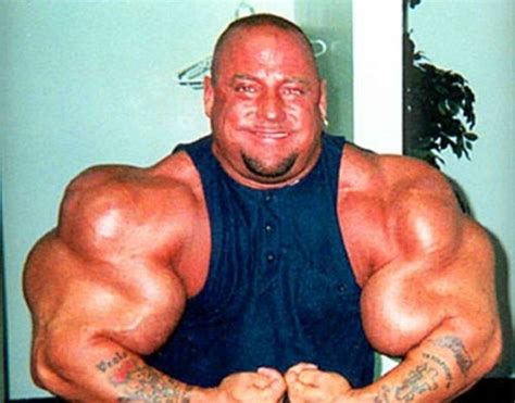 Another Synthol Victim 12 Pics