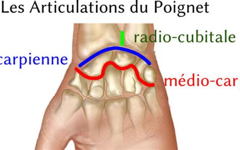 Arthrose Du Poignet Le Centre Chirurgical De L ARTHROSE