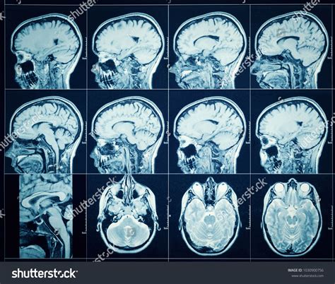 Closeup of a CT scan with brain. Science and education mri background. #Ad , #Ad, #scan#brain# ...