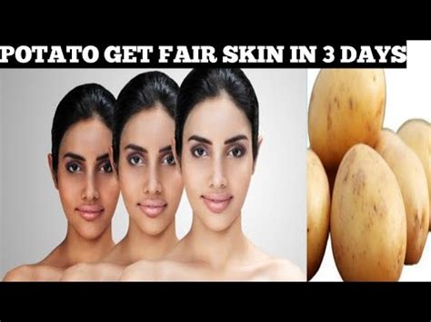 How To Use Potato To Treat Pigmentation Dark Spots Acne Free Skin