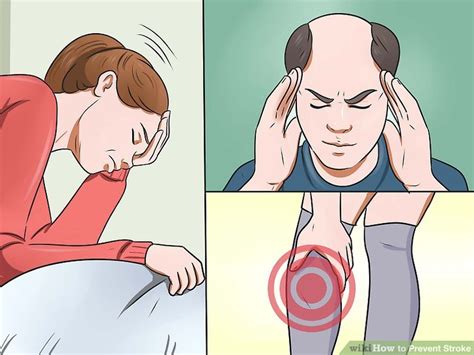 How To Prevent Stroke 8 Steps With Pictures Wikihow