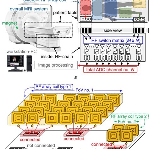 General Configuration Of MRI Hardware And RF Coils A Simplified