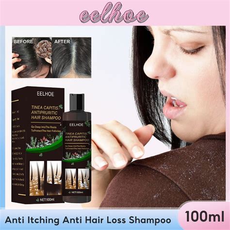 Jual Eelhoe Tinea Capitis Antipruritic Hair Shampoo Cocok Untuk