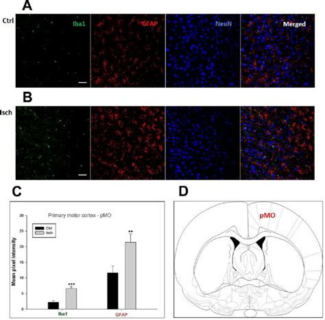 Confocal Images Of Microglia And Astrocytes In The Post Ischemic