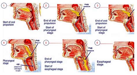 Adult Services Voice Swallowing And Stroke Mary Ellen Thompson Phd