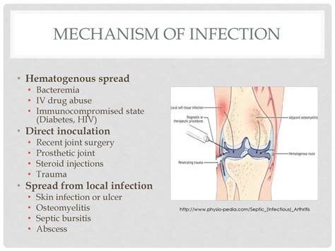 Septic Arthritis Pathophysiology