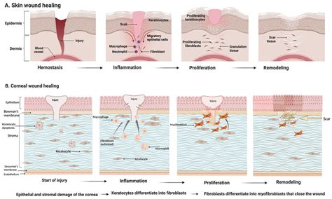 What Is The Correct Sequence For Wound Healing at Ronald Piper blog