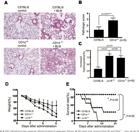 Figure From Natural Killer T Nkt Cells Attenuate Bleomycin Induced