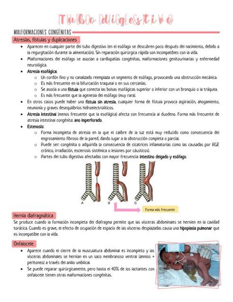 Malformaciones Congénitas del Tubo Digestivo Karol Galán uDocz