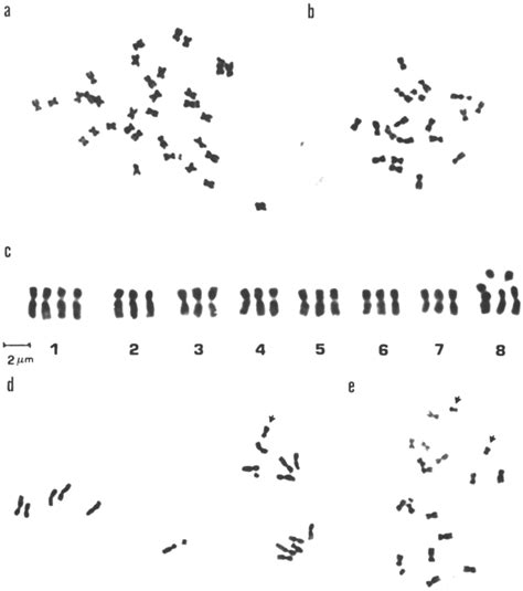 A E Mitotic Metaphases X Of A Plant With Chromosomes A And