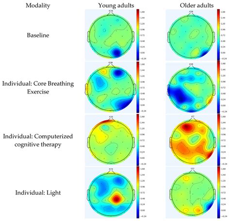 A Topographic Maps Following The Application Of Individual Modality