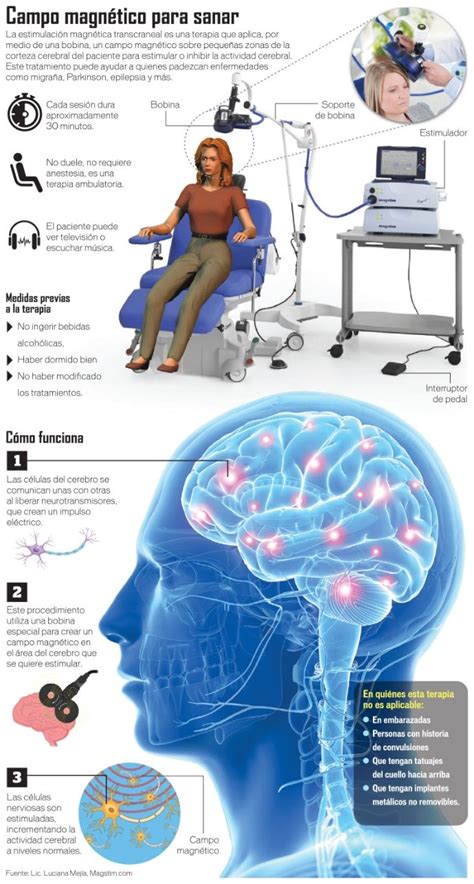 Estimulaci N Magn Tica Transcraneal Una Terapia Amigable Con La