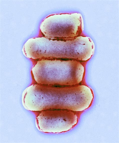 E Coli Bacteria Photograph By Centre For Infectionspublic Health Englandscience Photo Library