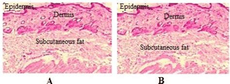 Histological Findings Of Skin Biopsies From Wistar Rats Control A