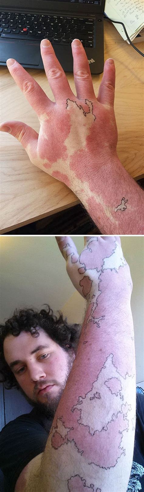 Guy Transformed His Birthmark Into A Map Of An Imaginary World By