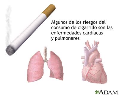 Riesgos De Salud Ocasionados Por El Tabaco MedlinePlus Enciclopedia