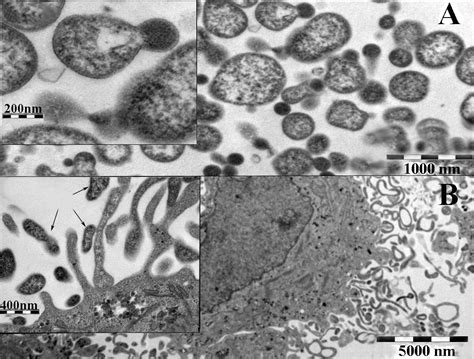 Contamination Of Tissue Cultures By Mycoplasmas Intechopen