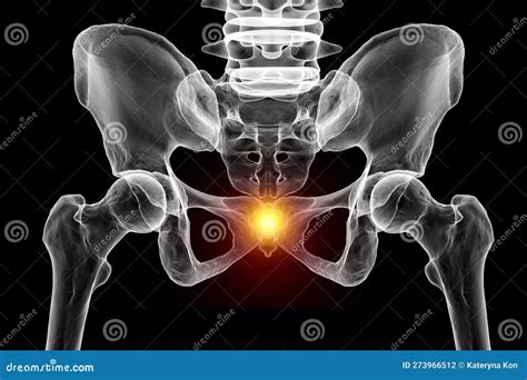 A 3D Medical Illustration Highlighting The Coccyx Bone Marked In Red ...