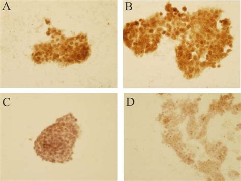 Immunocytochemical Analysis Of Inos Localization In Caco 2 Cells The