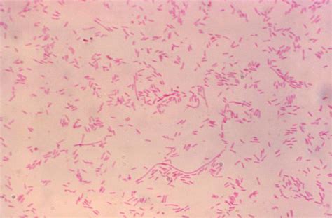 Legionella pneumophila: Properties, Pathogenesis, Lab Diagnosis ...