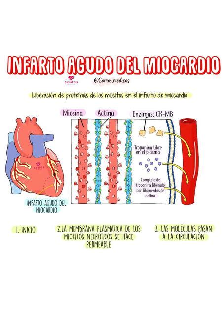 Infarto Agudo del Miocardio Fanpage Somos Médicos uDocz