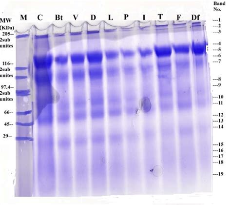 Sds Polyacrylamide Gel Of Denatured Protein Patterns In The Whole Body