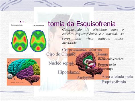 O Mundo Da Esquizofrenia Ppt Carregar