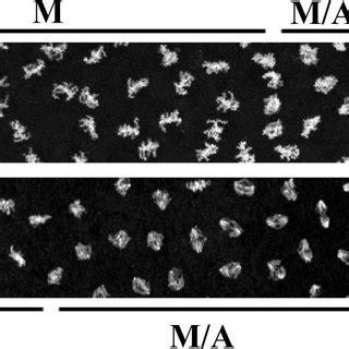 Vtd And Nipped B Mutations Result In Dominant Suppression Of Mrt A