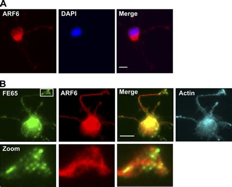 ARF6 Is Present In Perinuclear Regions And Processes In Developing