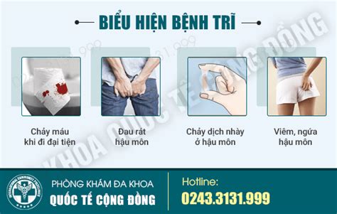 Bệnh Trĩ Là Gì Tổng Quan Bệnh Trĩ Tsbs Trịnh Tùng Bác Sĩ Trịnh Tùng