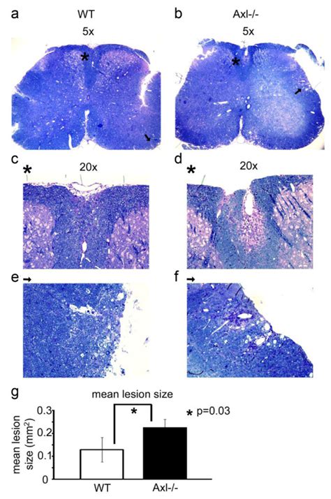 Axl Mice Have Larger Inflammatory Cuffs And Increased Demyelination