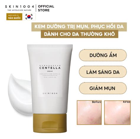 Kem Dưỡng Trị Mụn SKIN1004 Phục Hồi Da Mụn Chiết Xuất Rau Má 75ml