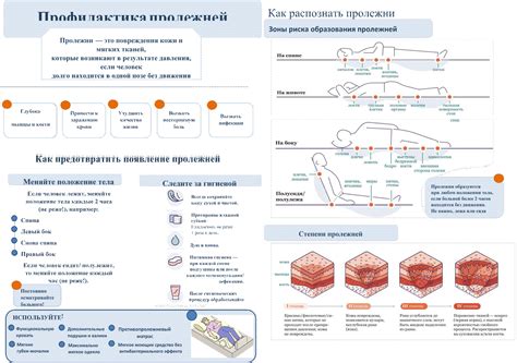 Профилактика пролежней