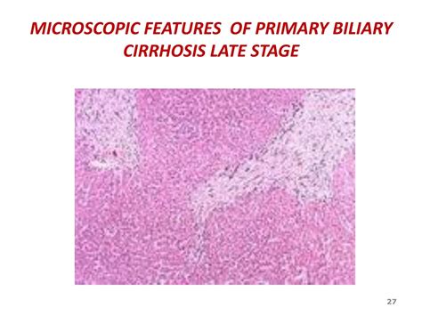 Ppt Cirrhosis Definition Causes And Morphology Powerpoint