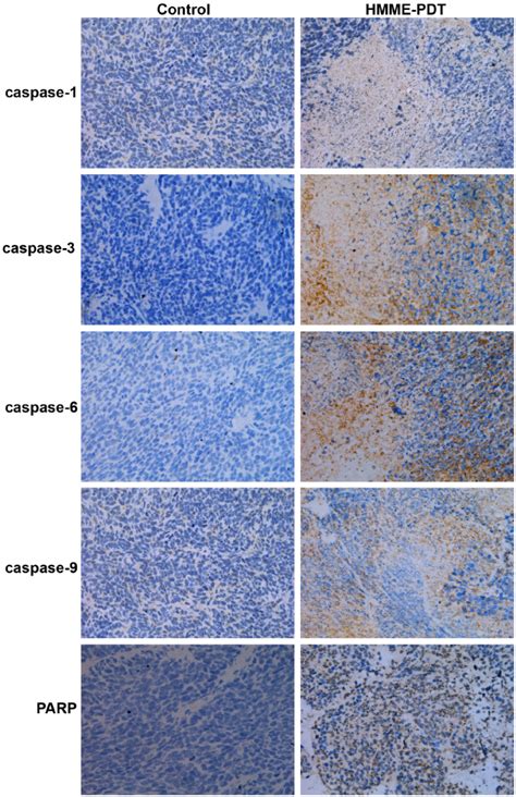 Immunohistochemistry Ihc Detection After Hmme Pdt 6 200 Tumors