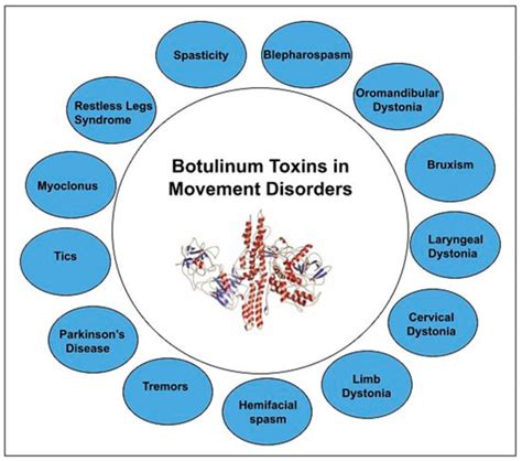 Toxins Free Full Text Botulinum Toxin In Movement Disorders An Update