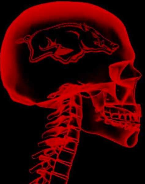 A Red X Ray Image Of A Human Skull